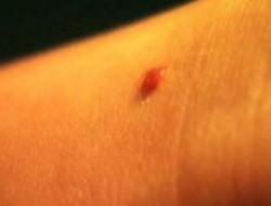 守宫砂为什么会在同房后消失（毫无科学依据）