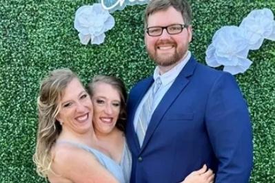 “共享”身体34年！美国连体双胞胎姐妹其中一人已婚